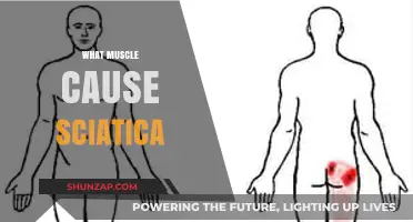 Understanding Sciatica: Which Muscles Trigger This Painful Condition?