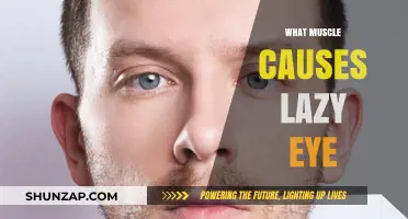 Understanding Lazy Eye: The Role of Eye Muscles in Strabismus