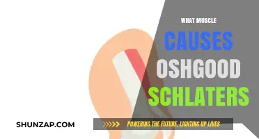 Understanding Osgood-Schlatter Disease: The Role of the Patellar Tendon