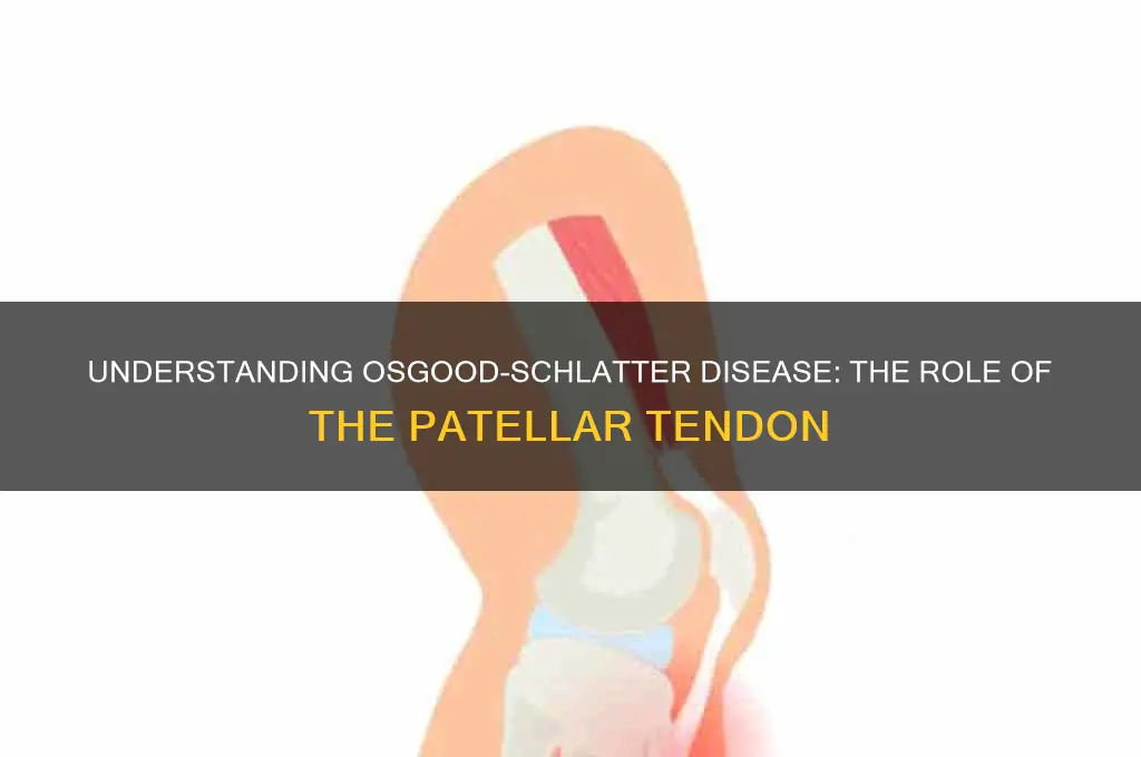 what muscle causes oshgood schlaters