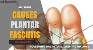 Unveiling the Muscle Link to Plantar Fasciitis Pain and Relief