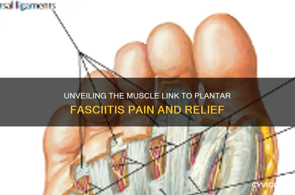 what muscle causes plantar fasciitis