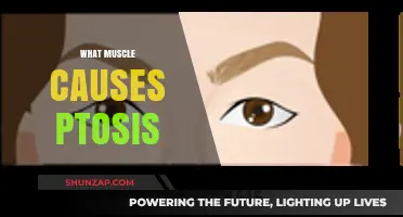 Understanding Ptosis: The Role of the Levator Muscle in Drooping Eyelids