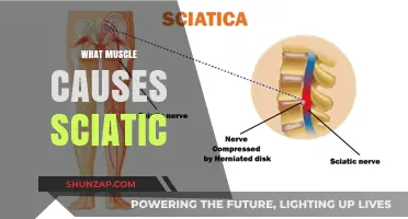 Sciatic Pain Explained: The Key Muscle Culprit and Relief Tips