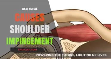 Understanding Shoulder Impingement: Key Muscles and Their Role in Pain