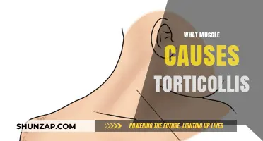 Understanding Torticollis: The Role of the Sternocleidomastoid Muscle Explained