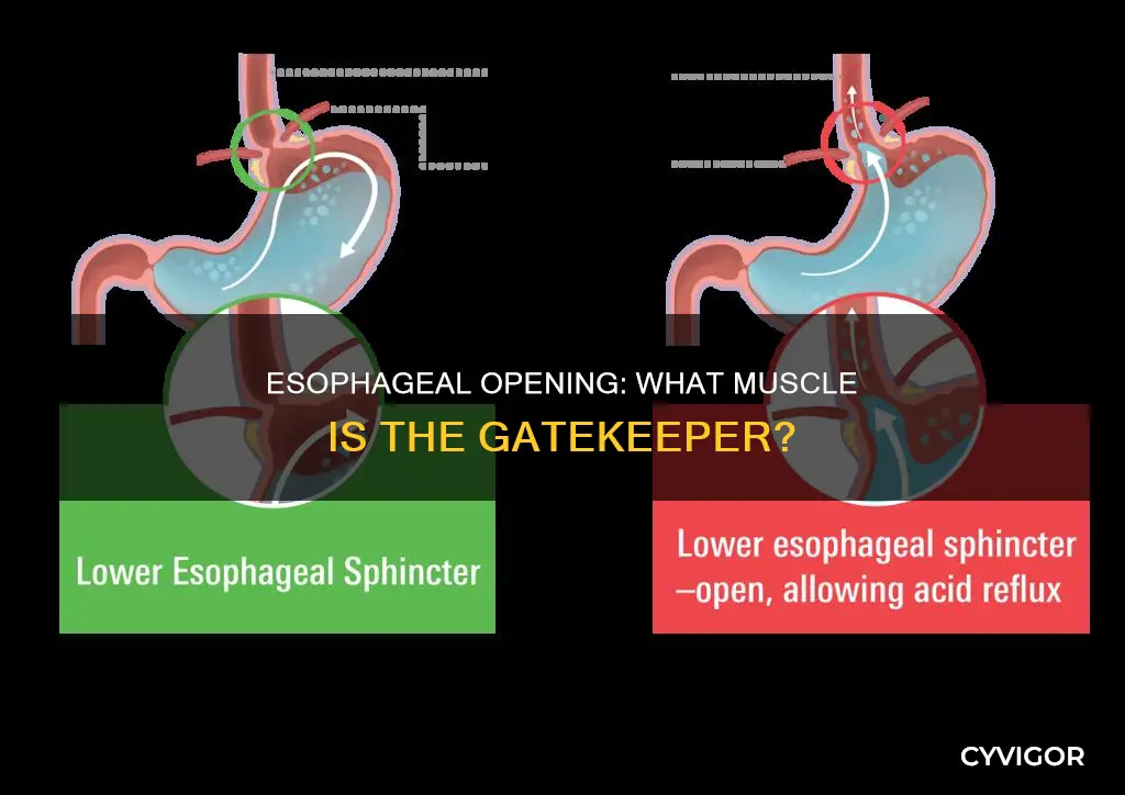 what muscle constricts esophageal opening