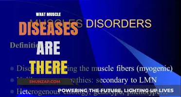 Muscle Diseases: Types and Their Impact
