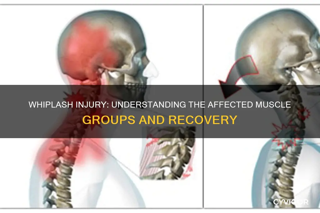 what muscle group is hurt whip lash