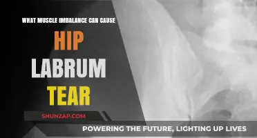 Muscle Imbalances Leading to Hip Labrum Tears: Causes and Prevention