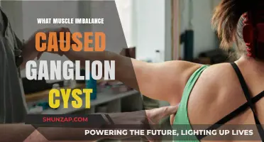 Muscle Imbalance and Ganglion Cysts: Unraveling the Connection