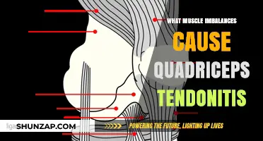 Understanding Quadriceps Tendonitis: Muscle Imbalances and Their Role