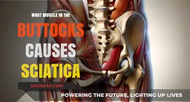 Piriformis Syndrome: How Buttock Muscles Trigger Sciatica Pain Explained