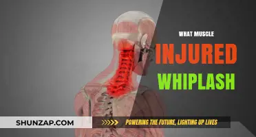 Understanding Whiplash: Which Muscles Are Affected?