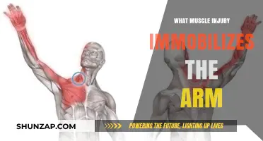 Understanding the Muscle Injury That Immobilizes Your Arm: Causes and Recovery