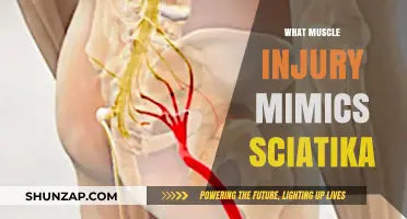 Muscle Mystery: Unveiling Sciatica Imposters
