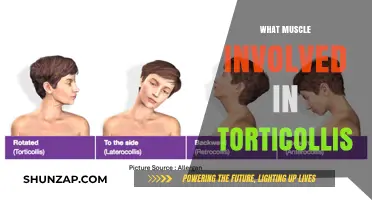 Muscle Anatomy of Torticollis