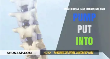 Intrathecal Pain Pump Placement: Targeting the Ideal Muscle for Relief