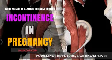 Pregnancy-Related Urinary Incontinence: The Role of Pelvic Floor Muscles