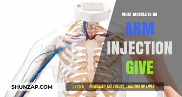 Where to Inject in the Arm: Targeting the Right Muscle Safely