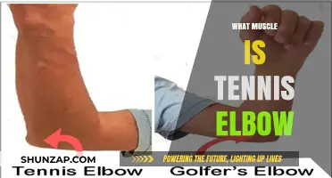 Tennis Elbow: Extensor Muscle Pain
