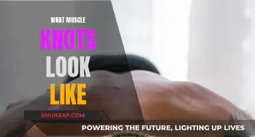 Muscle Knots: Understanding Their Appearance and Your Health