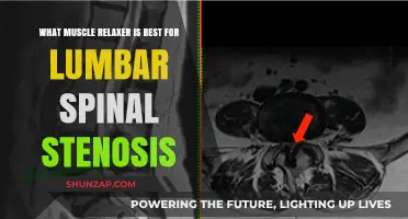 Best Muscle Relaxers for Lumbar Spinal Stenosis Relief: Expert Recommendations