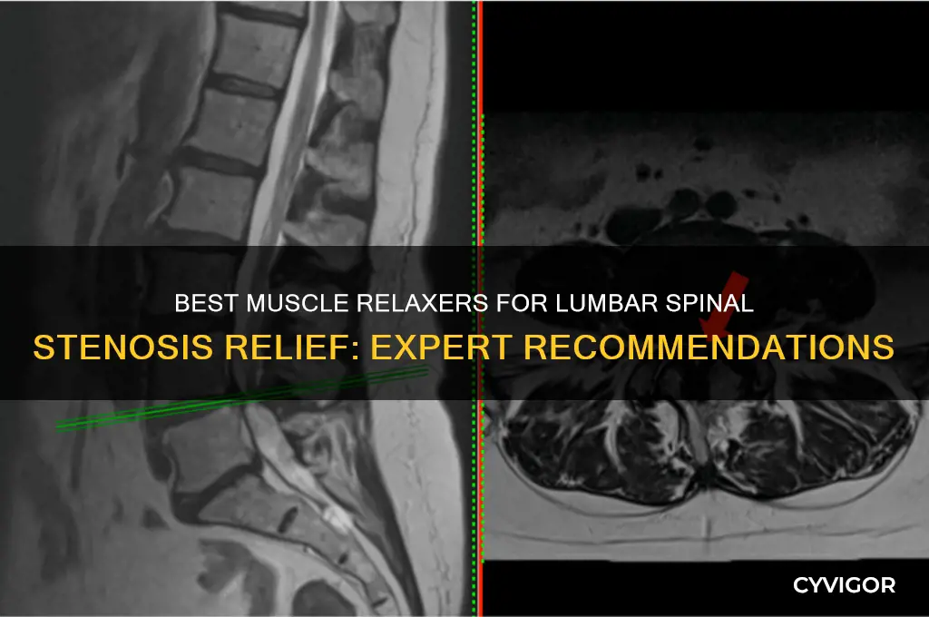 what muscle relaxer is best for lumbar spinal stenosis