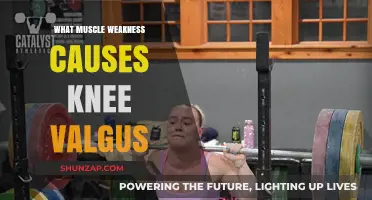 Understanding Knee Valgus: Muscle Weaknesses That Contribute to Misalignment