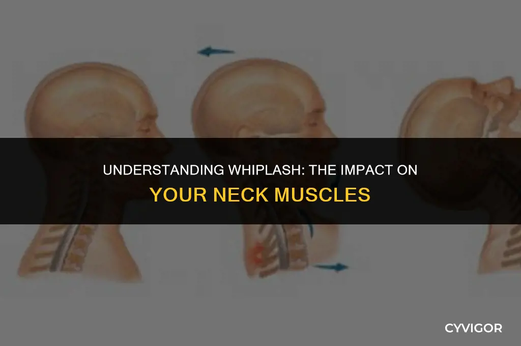 what muscles are affected by whiplash