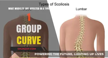 Type 1 Group Curve: Muscles Impacted and Their Role Explained