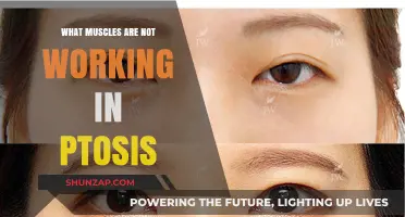 Understanding Ptosis: Which Muscles Fail to Lift the Eyelid?