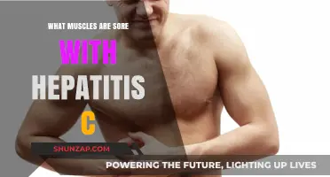 Hepatitis C and Muscle Pain: Understanding Soreness and Affected Areas