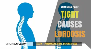 Tight Muscles and Lordosis: Understanding the Connection and Relief