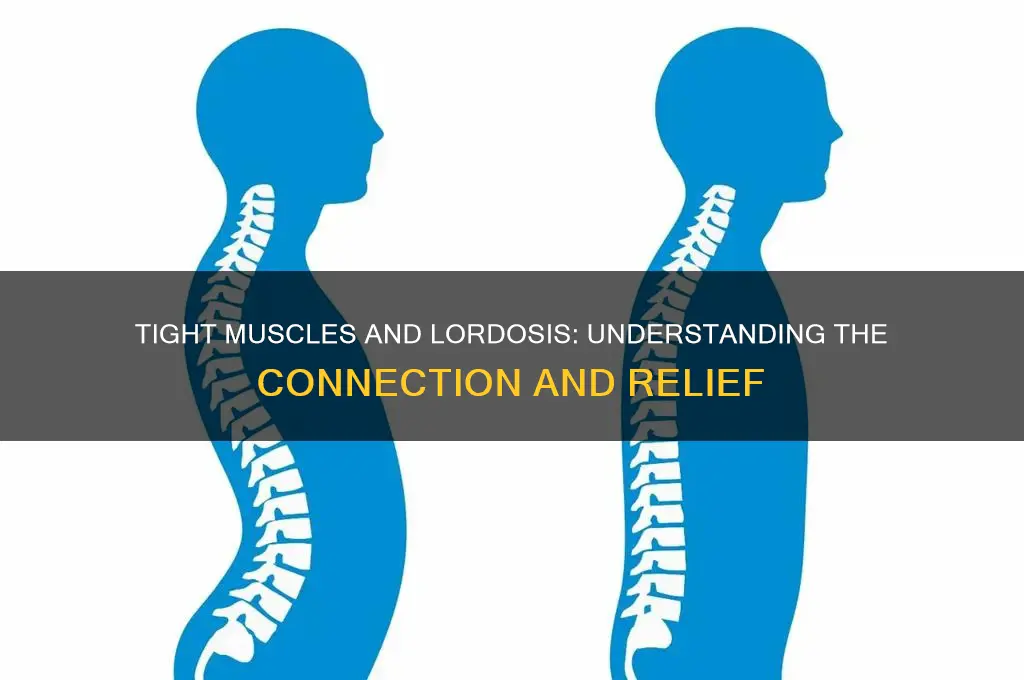 what muscles are tight causes lordosis