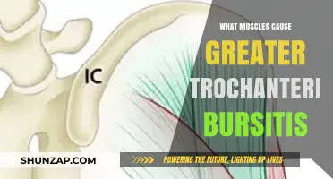 Muscles Linked to Greater Trochanteric Bursitis: Causes and Prevention