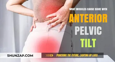 Muscles Behind Anterior Pelvic Tilt: Causes and Solutions