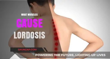 Understanding Lordosis: Key Muscles Responsible for Spinal Curvature