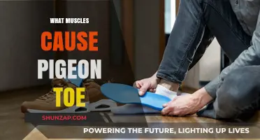 Understanding Pigeon Toe: Muscles and Factors Behind In-Toeing Feet