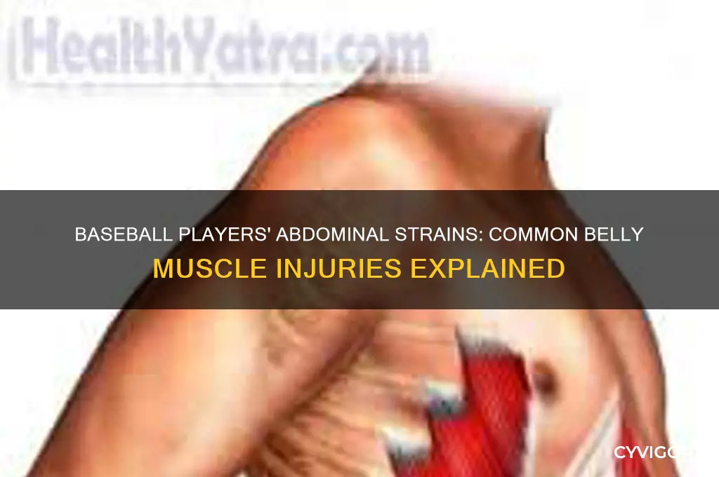 what muscles do baseball players pull in their belly