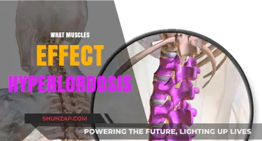 How Hyperlordosis Affects Your Muscles and Core