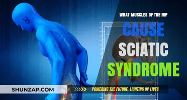 Hip Muscles Linked to Sciatic Syndrome: Causes and Connections