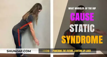 Hip Muscles Linked to Static Syndrome: Causes and Solutions
