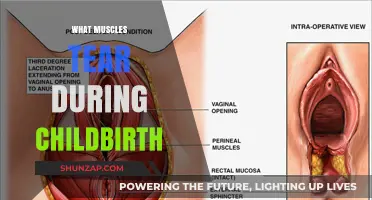 Childbirth's Muscle Tears: What's at Risk?