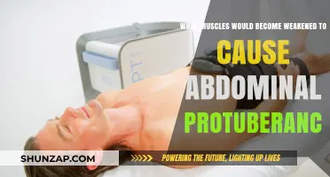 Weak Core Muscles: The Hidden Cause of Abdominal Protuberance