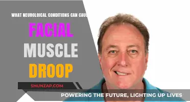 Understanding Facial Muscle Droop: Neurological Conditions Behind the Symptom