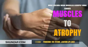 Muscle Atrophy Explained: Causes and Effects of Muscle Loss