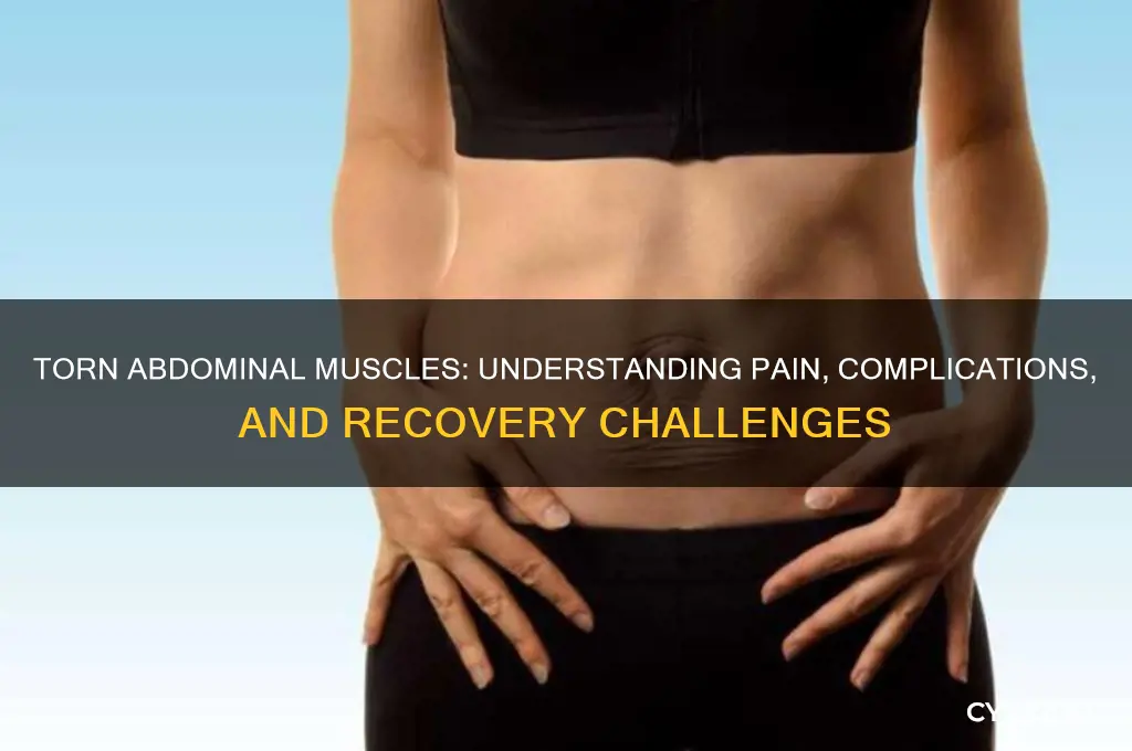 what problems can torn abdominal muscles cause