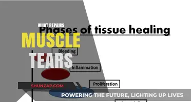 Healing Muscle Tears: The Ultimate Guide to Recovery