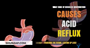How Lower Esophageal Sphincter Dysfunction Triggers Acid Reflux Symptoms